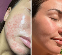 Juvona™ Ultra-light Facial Mask